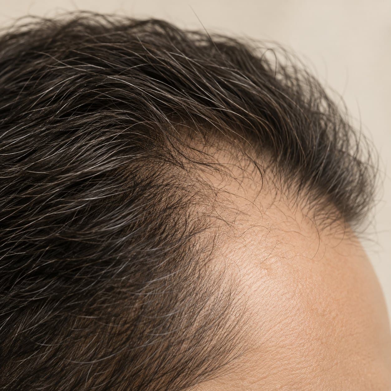 Close crop of a thinning hairline, no face