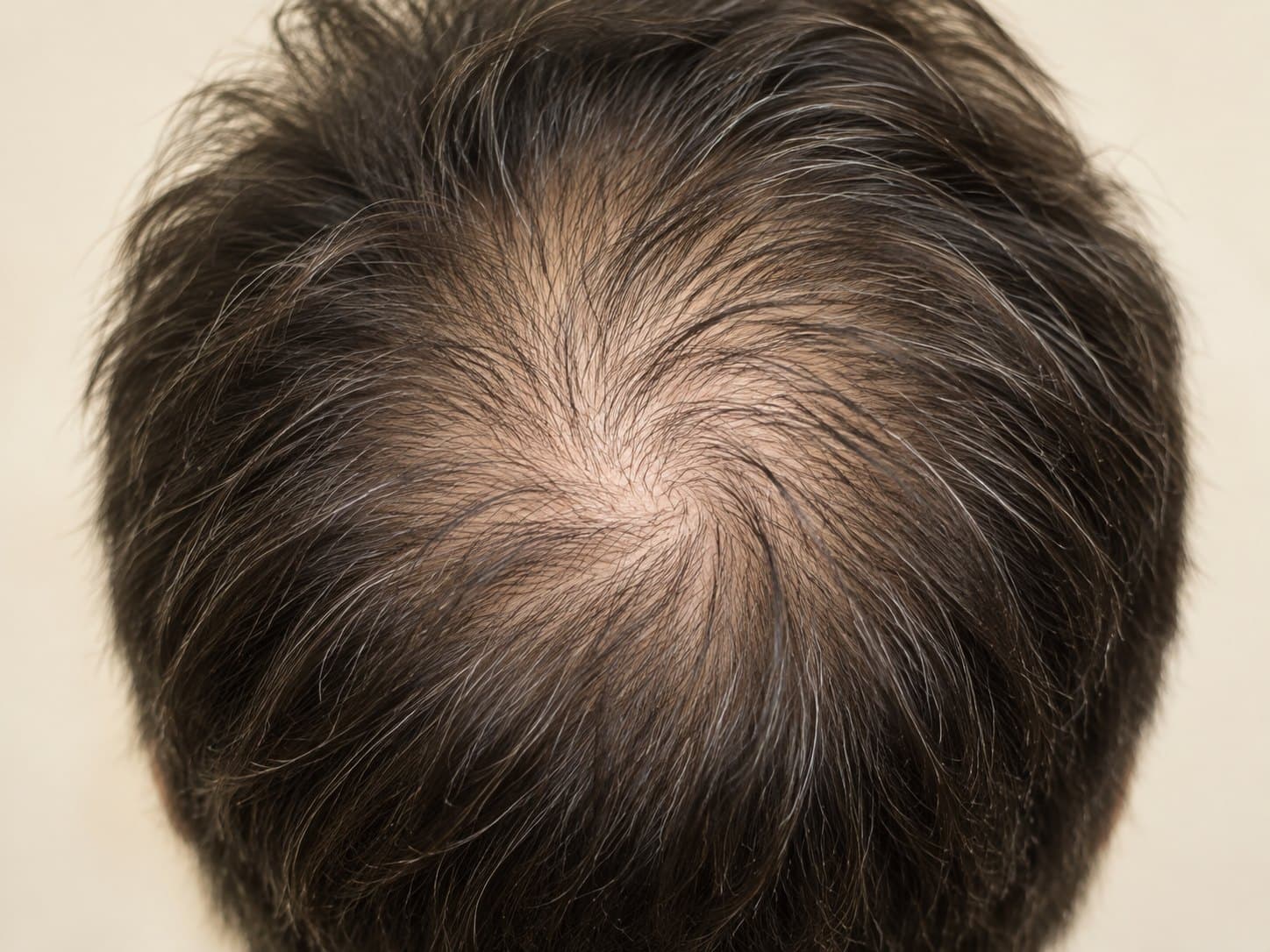 Top-down view of crown thinning